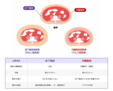 脂肪吸引だと内臓脂肪は落とせない！？