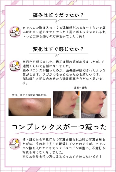 もっと早く受けていればよかった…