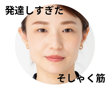 エラの張り