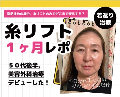 【糸リフト1ヶ月密着】糸リフトのみでどのくらい変化する？【脂肪多め50代後半女性】