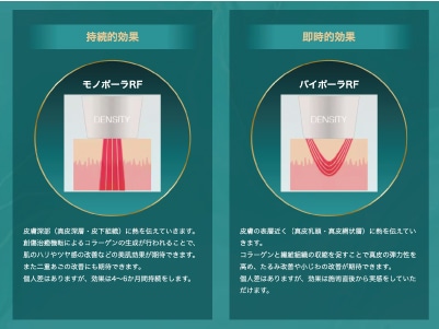 最大のポイントは