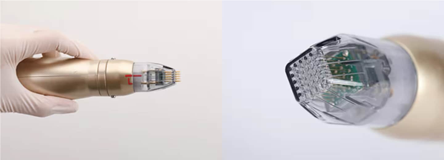 お肌に極細の針を刺す、ニードルRF