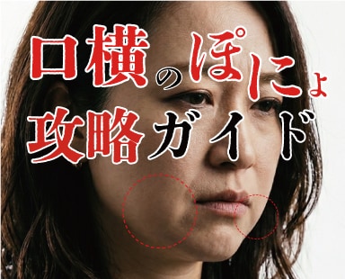 口横のぽにょ攻略ガイド!外科専門医が原因と治療方法を解説します。湘南美容クリニック熊谷院