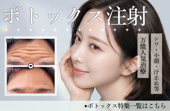 【ボトックス】シワ対策/小顔/汗止めなどに！万能人気治療ボトックス