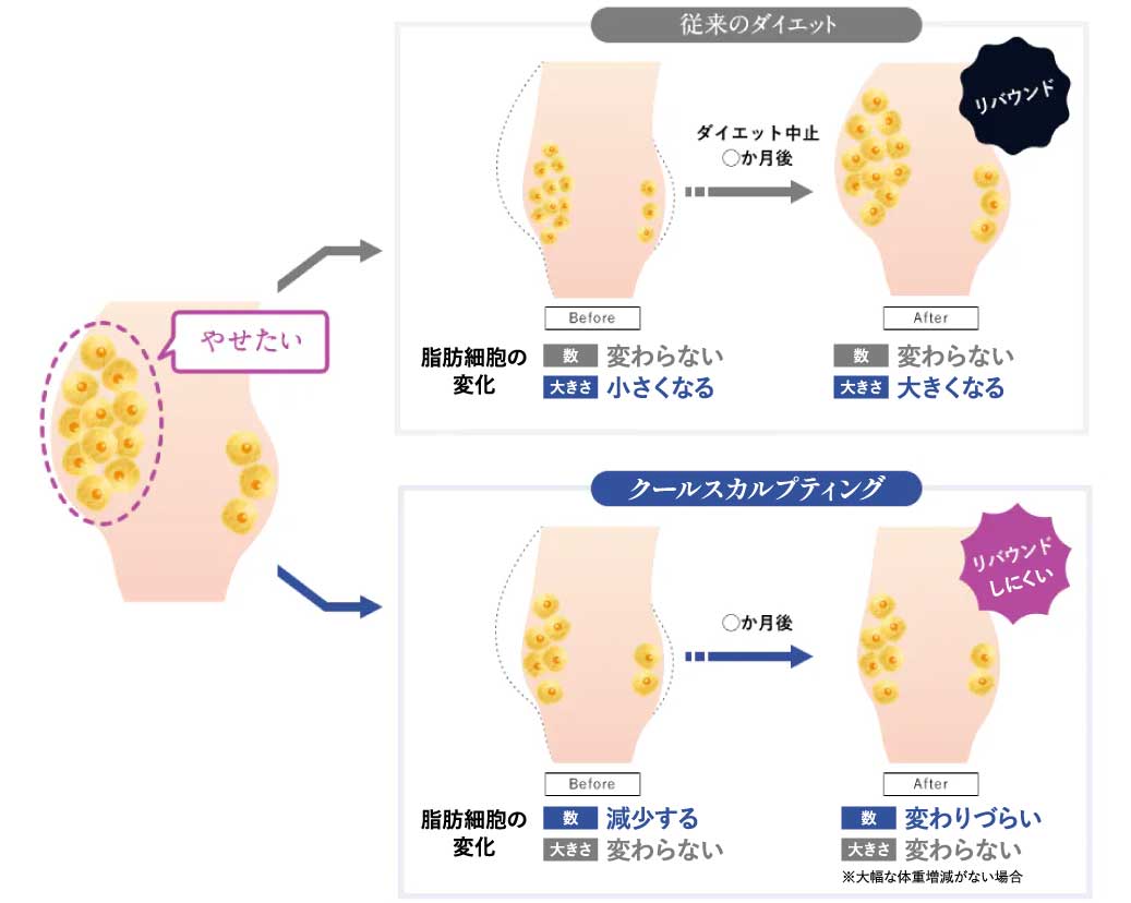 リバウンドしづらいのがメリット