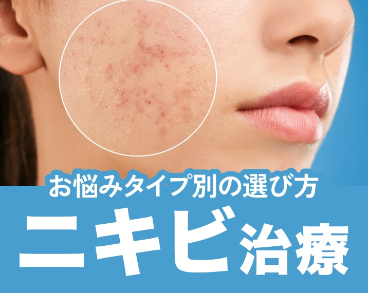 【熊本】もう悩まない！ニキビ・ニキビ跡治療完全ガイド｜お悩み別の最適な選び方