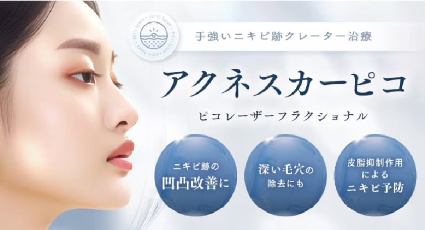 アクネスカーピコ