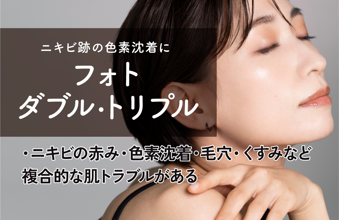 フォトダブル・トリプル