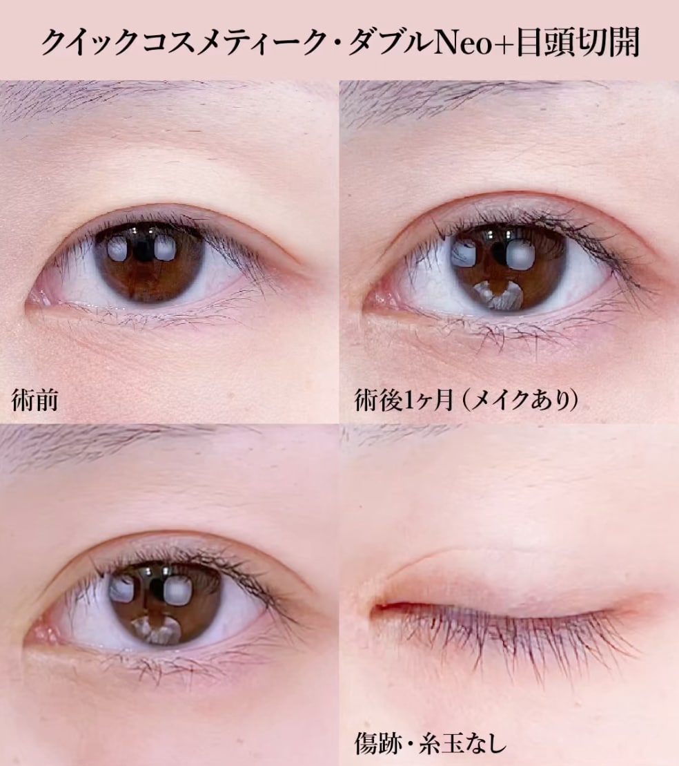 お客様のなりたい目元に合わせたお施術の提案