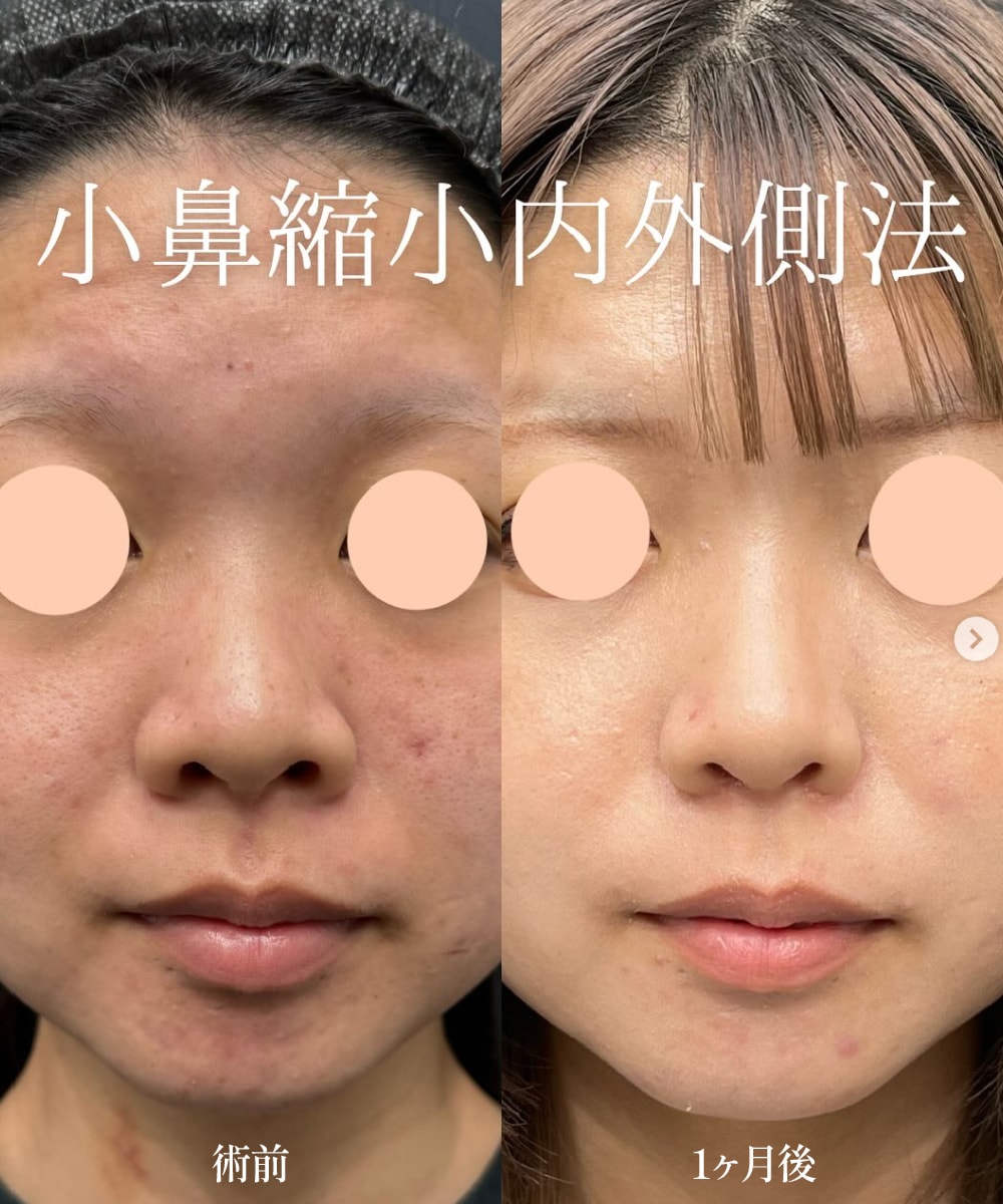 まずは中溝院長執刀の症例写真をご覧ください