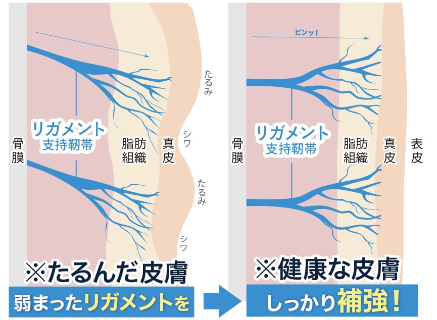 たるみの原因「リガメント」を強化🔥