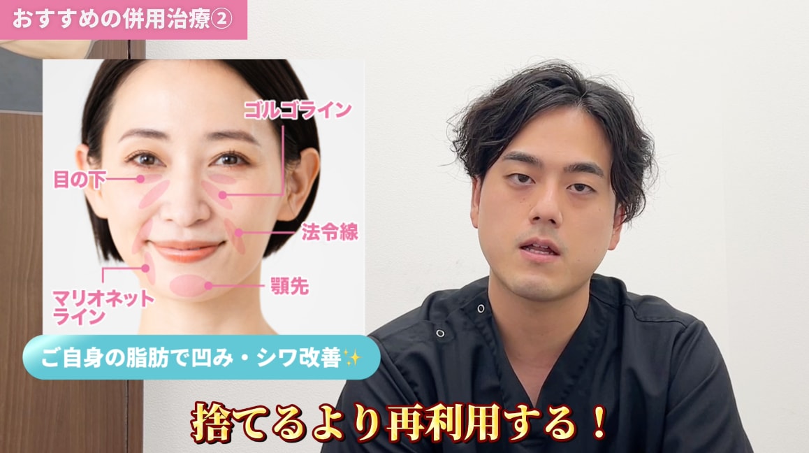 ②脂肪注射(脂肪注入)