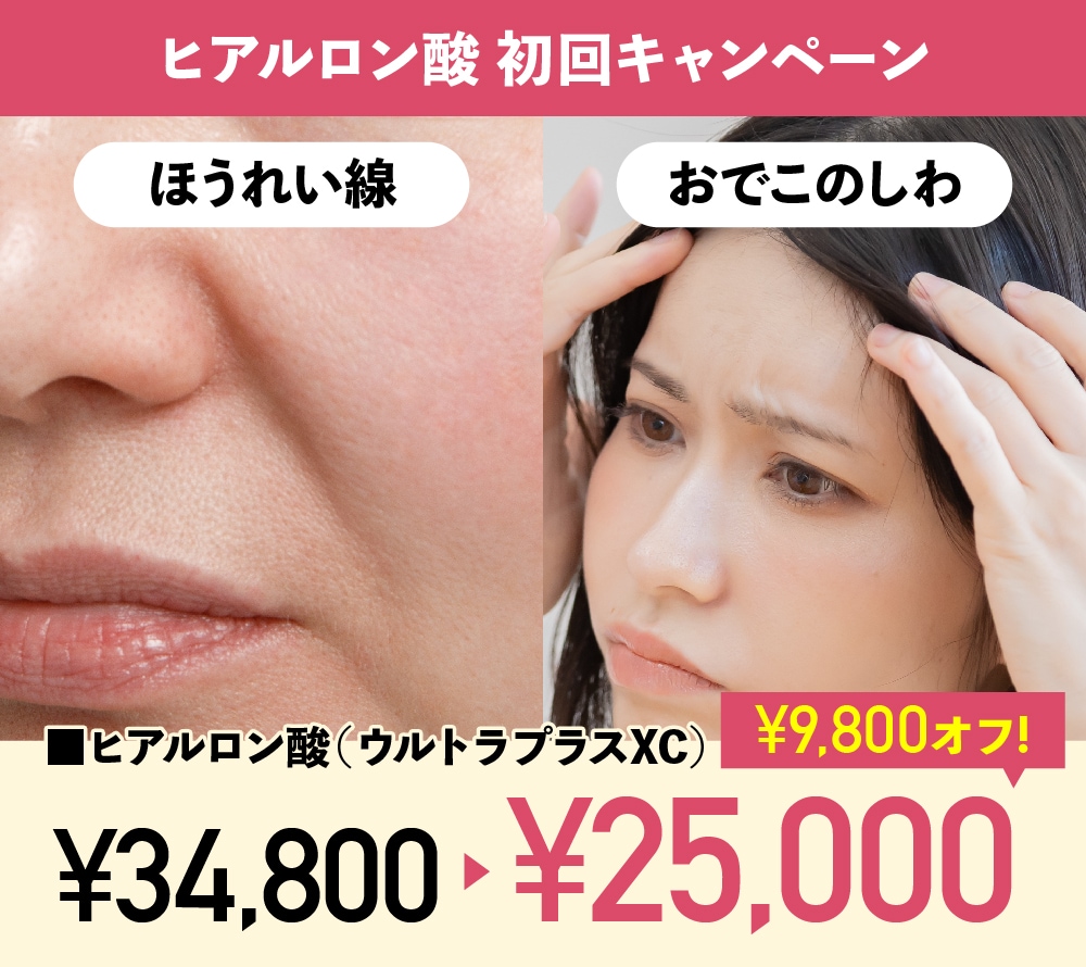ほうれい線・おでこのシワ、気になりませんか？