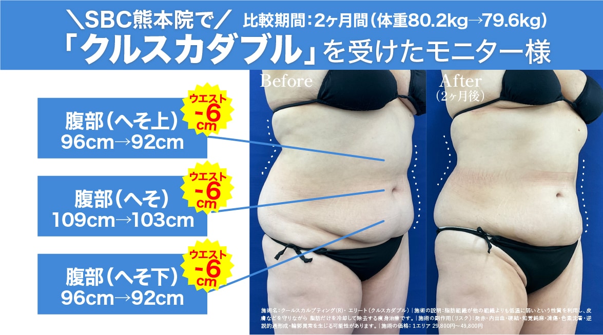 手術は怖いけど「確実な効果」が欲しかった。