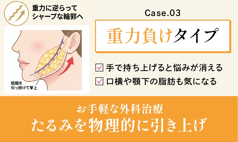 【物理的に引き上げる】 重力に逆らってシャープな輪郭へ
