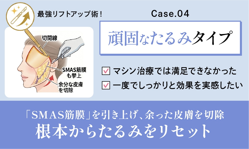 【外科・切る治療】根本から解決！最強のたるみ治療