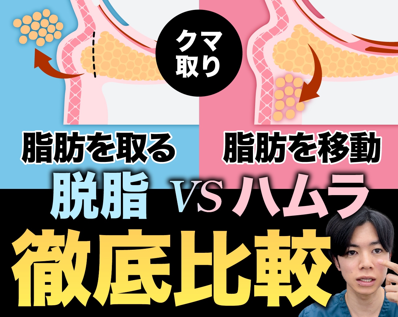 【熊本のクマ取り】脱脂 vs 裏ハムラ法、どっちがいい？中溝院長が5つのポイントで徹底比較！