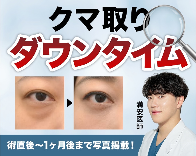 【裏ハムラ|クマ取り】ダウンタイム攻略法🔥