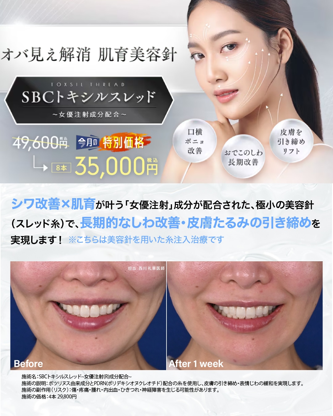 《11月限定特別価格》SBCトキシルスレッド〜女優注射成分配合〜