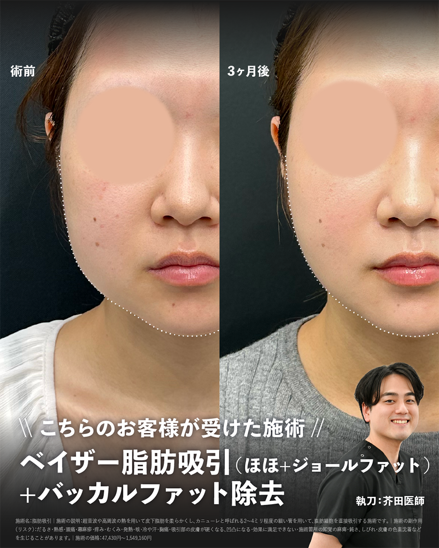 まずは芥田医師の症例写真をご覧ください📸