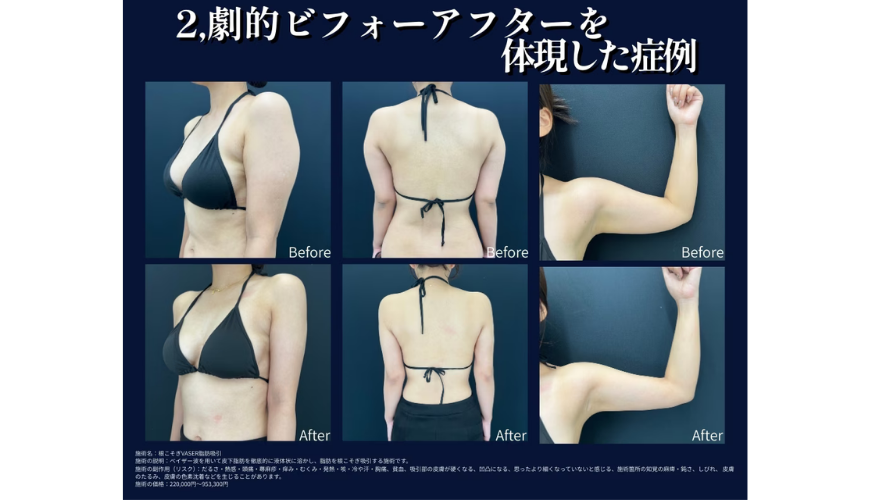 ②劇的ビフォーアフター