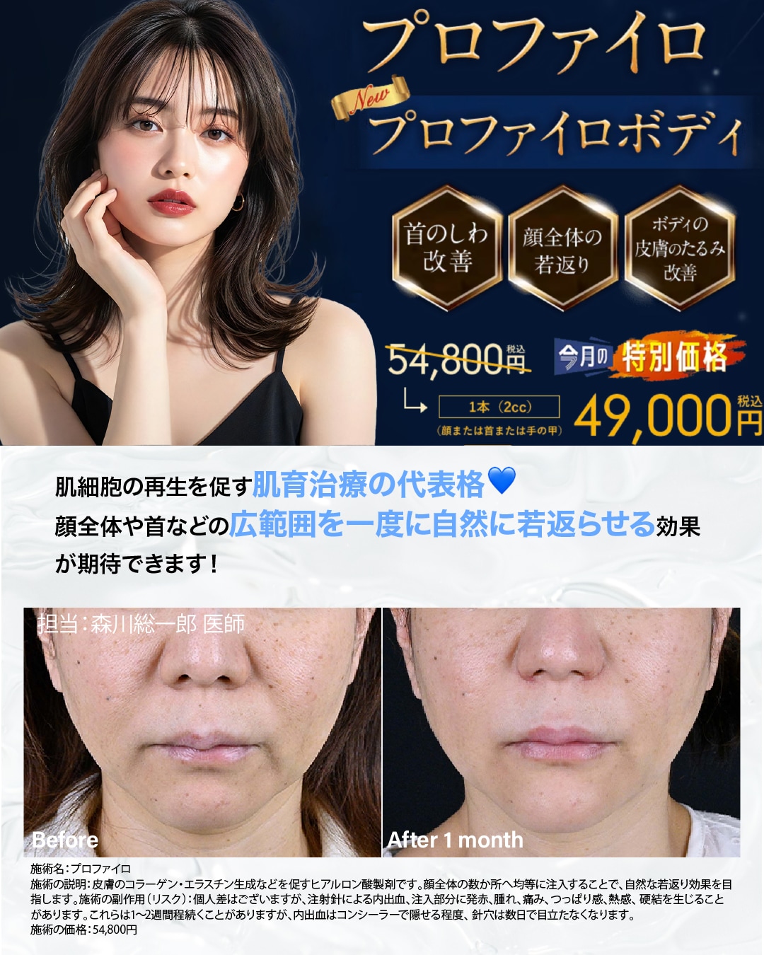 《11月限定特別価格》プロファイロ