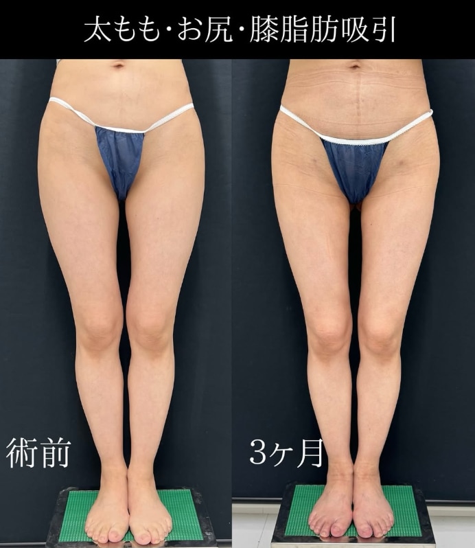 元々細い方も、さらに引き締まった足へ