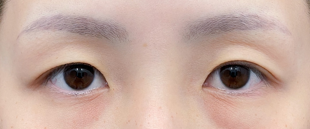 経過をすべてお見せします！