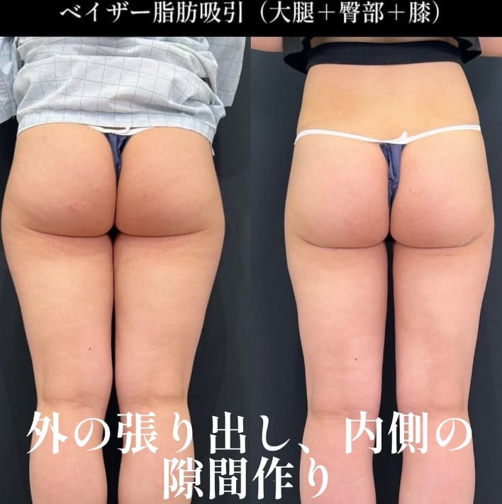 お尻の形も変わる！後ろ姿にも自信✨