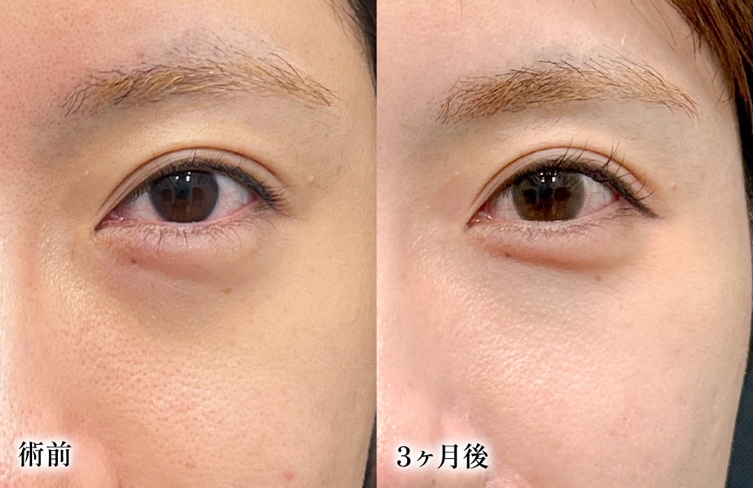 気になる完成形は！？