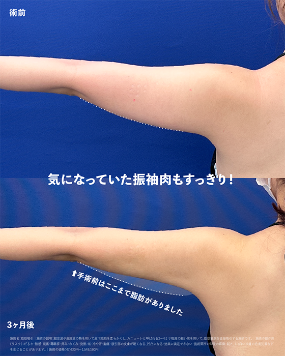 平岡医師 症例写真