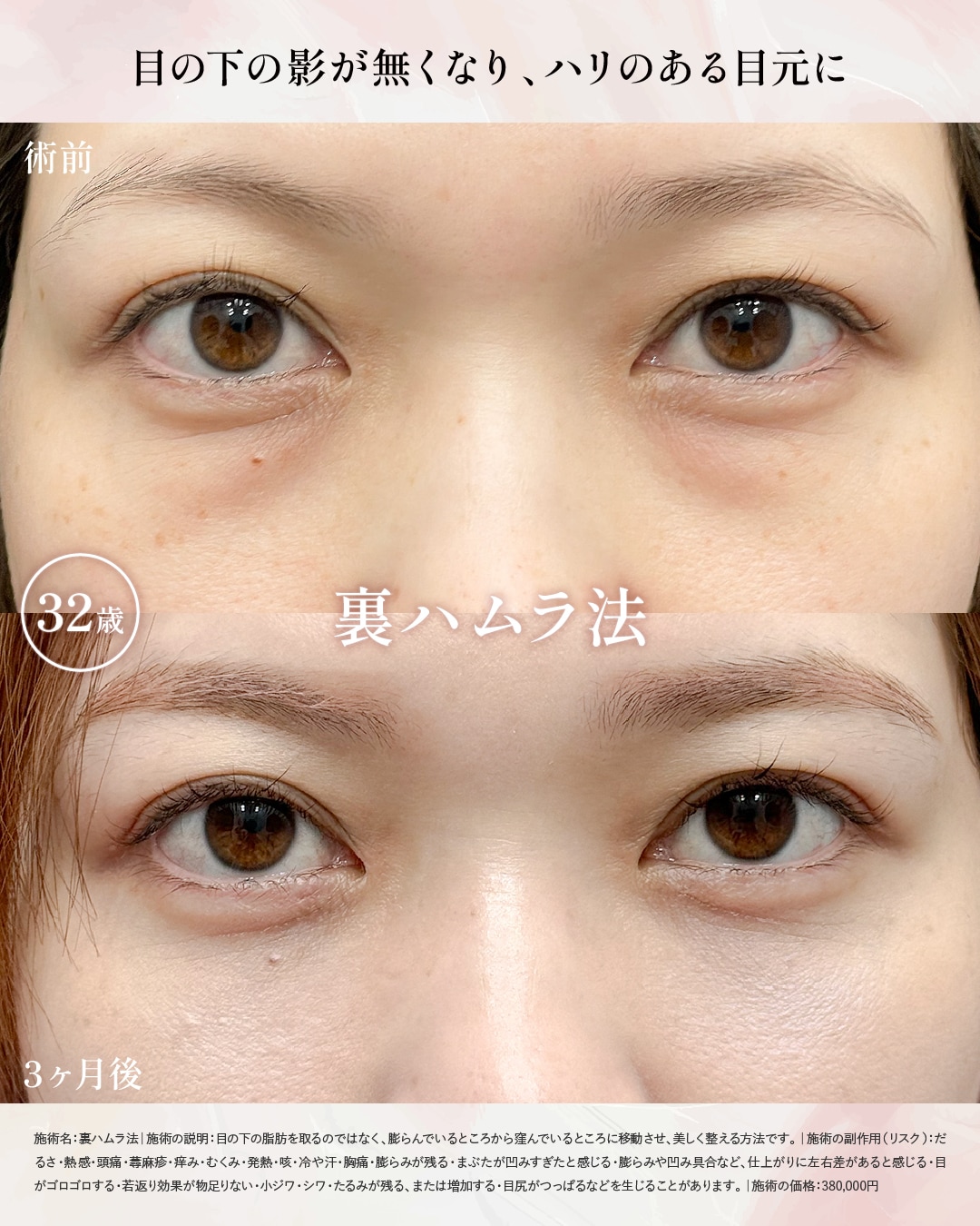 中溝院長 症例写真1