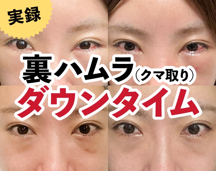 【スタッフが10日間自撮り】裏ハムラのリアルダウンタイム