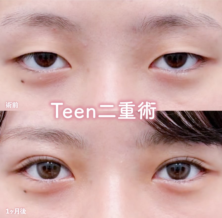 堺医師 症例写真