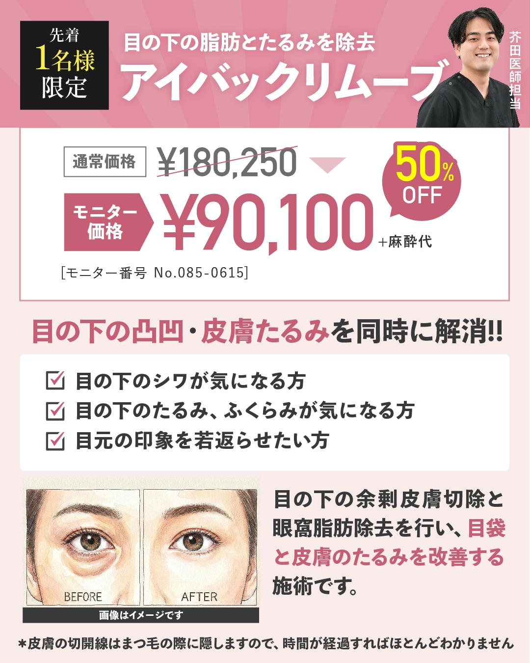 アイバックリムーブ