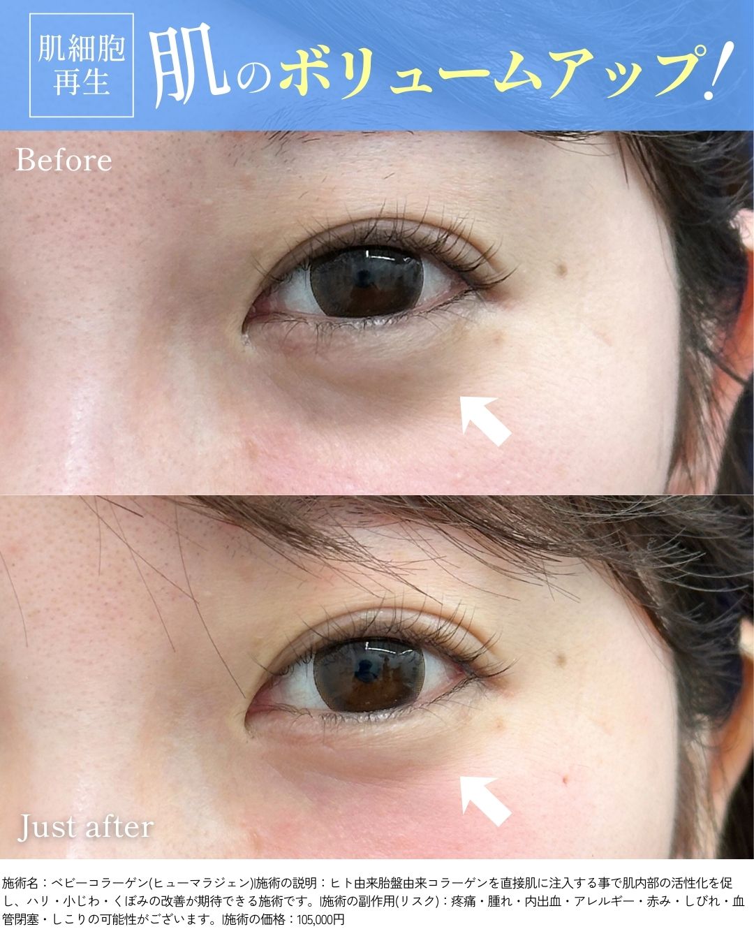 ↓before・after↓