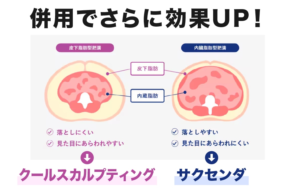 サクセンダとクールスカルプティングの併用が最適解