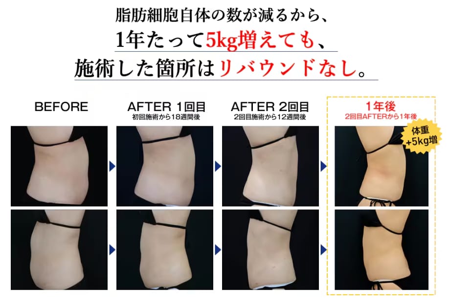 【選ばれる理由①】リバウンドしにくい