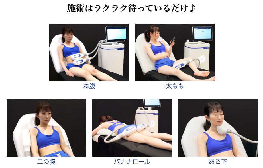 クールスカルプティングとは？