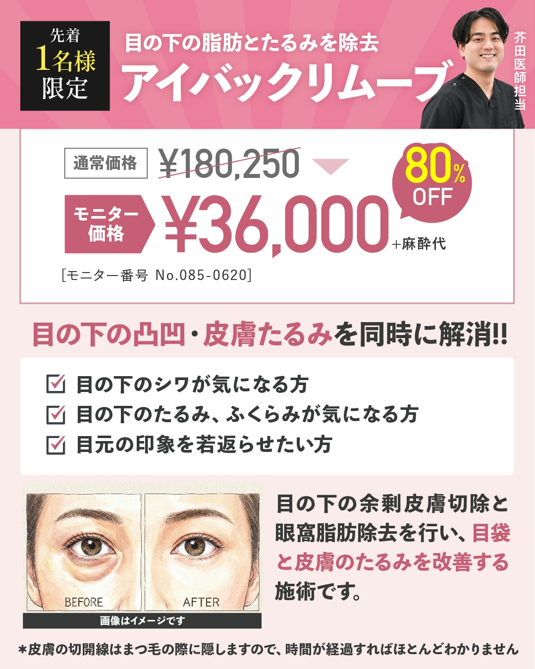 アイバックリムーブ