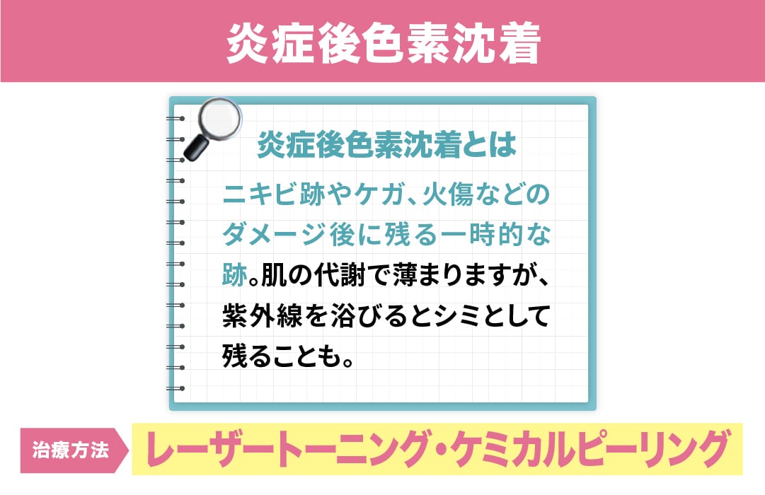 【炎症後色素沈着】<br />
