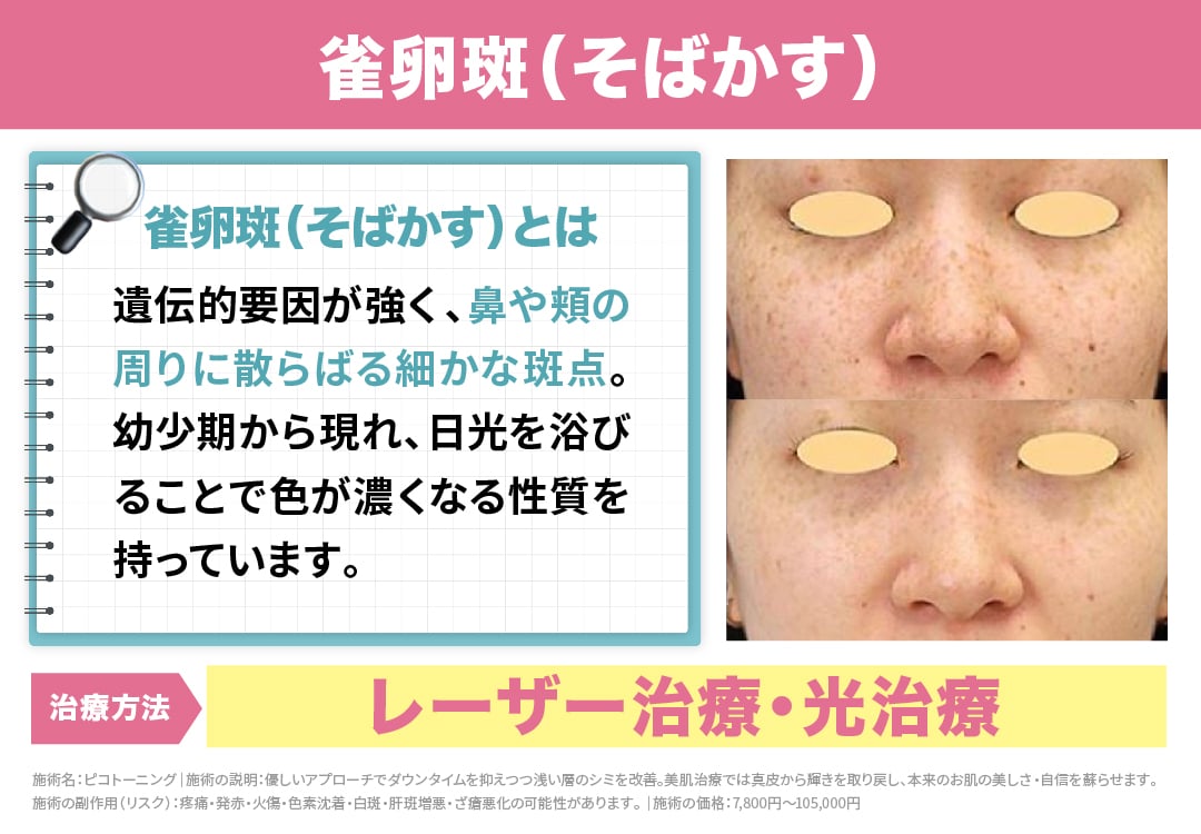 【雀卵斑（そばかす）】<br />
