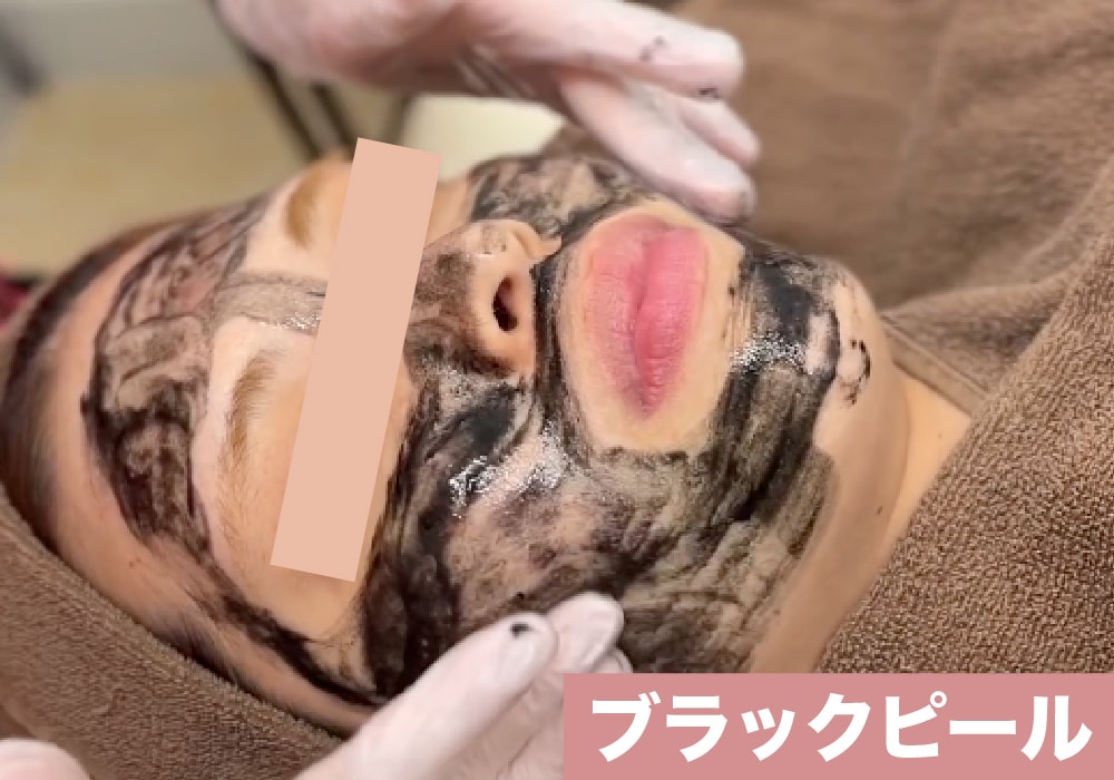 ブラックピール