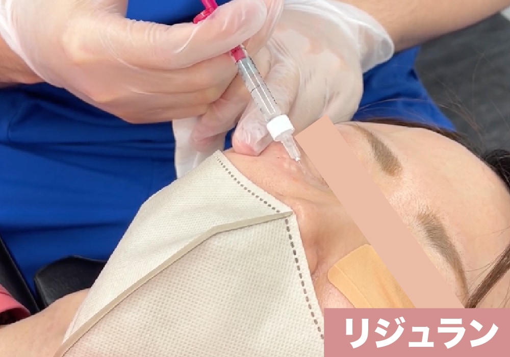 リジュラン