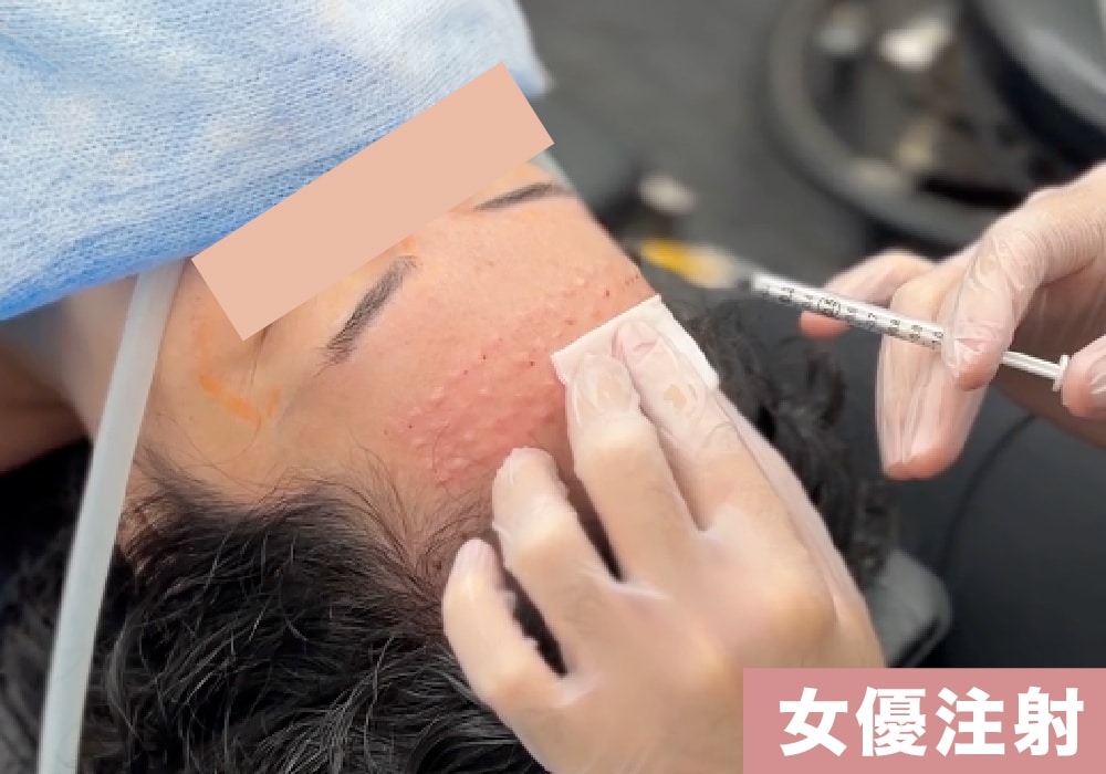 女優注射（SBCオリジナル）