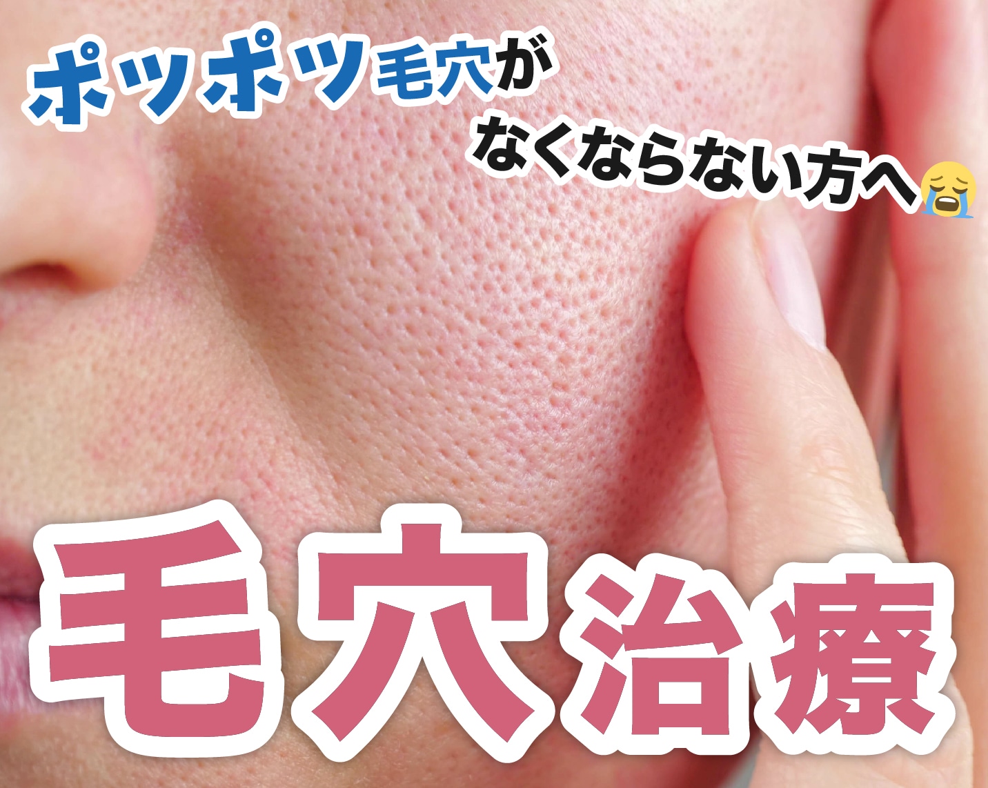 【熊本】もう毛穴で悩まない！毛穴治療11種類をわかりやすく解説♪