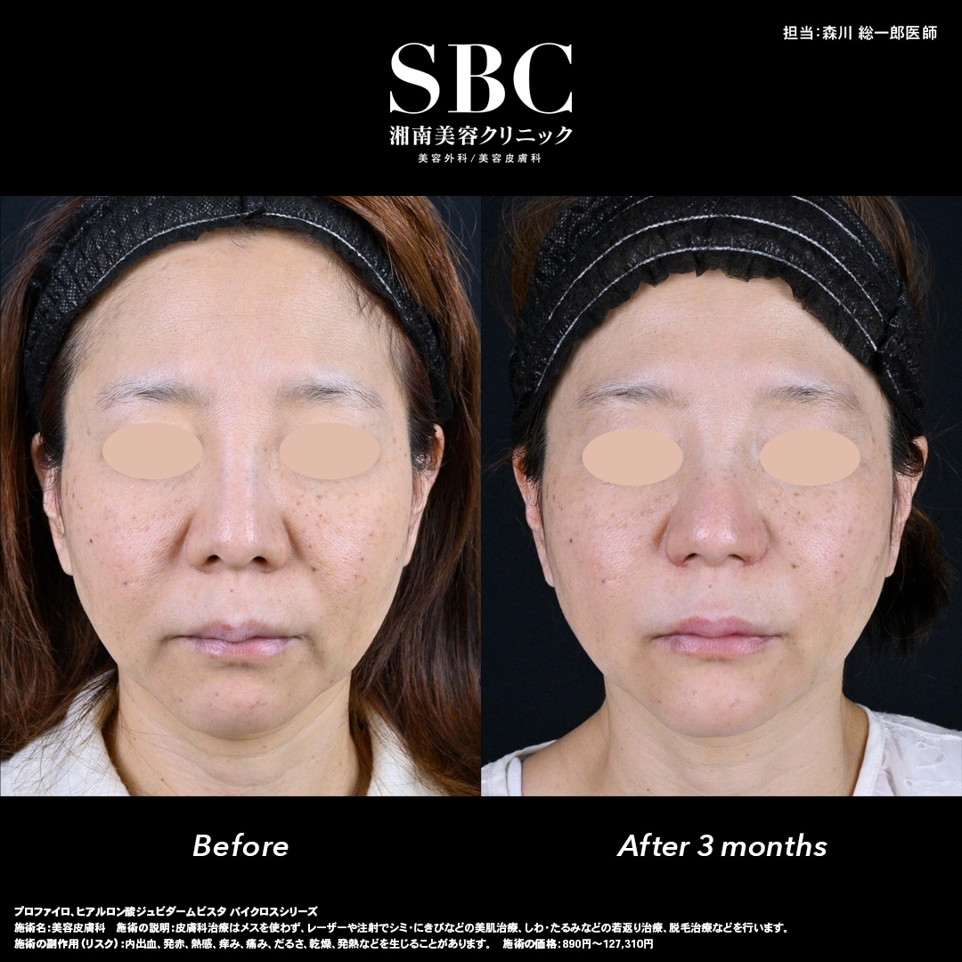 症例写真はこちら