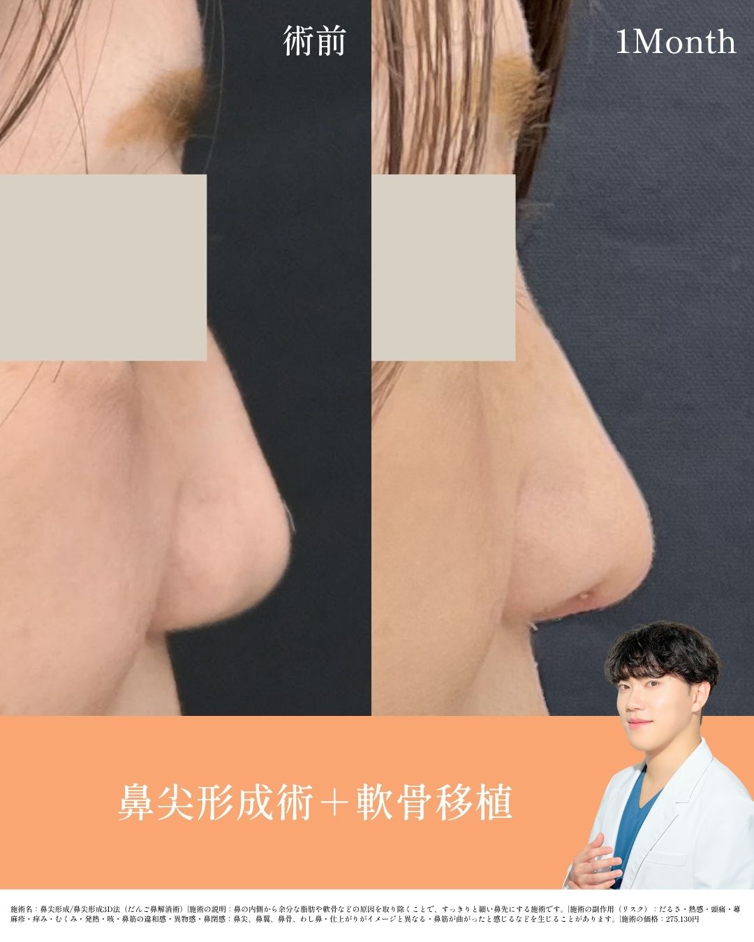 満安医師執刀の症例写真をご覧ください
