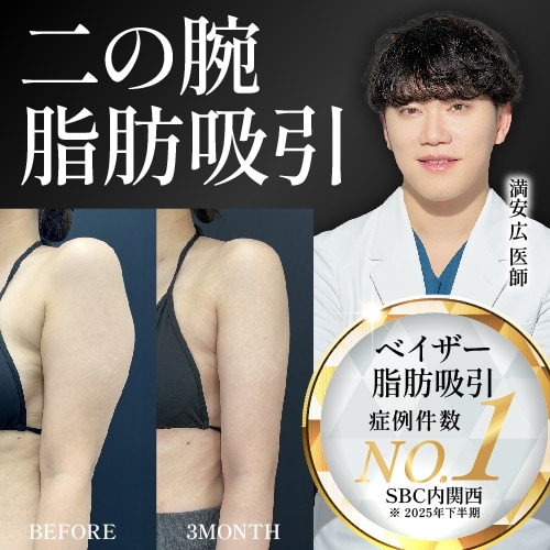 【熊本】二の腕の脂肪吸引なら満安医師にお任せ！
