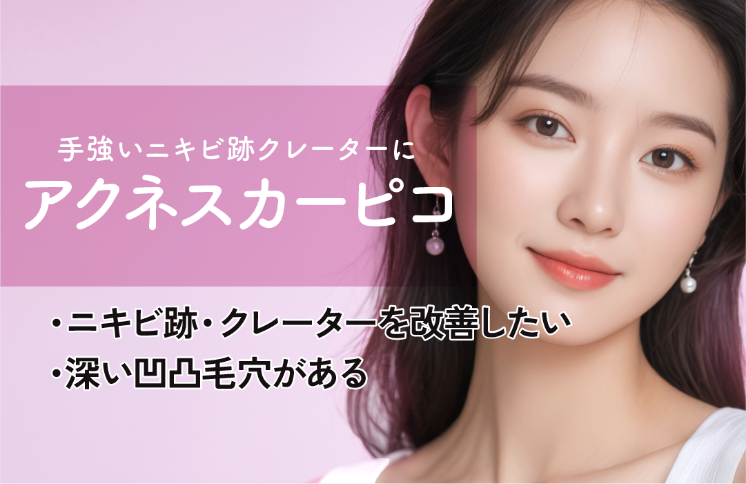 アクネスカーピコ